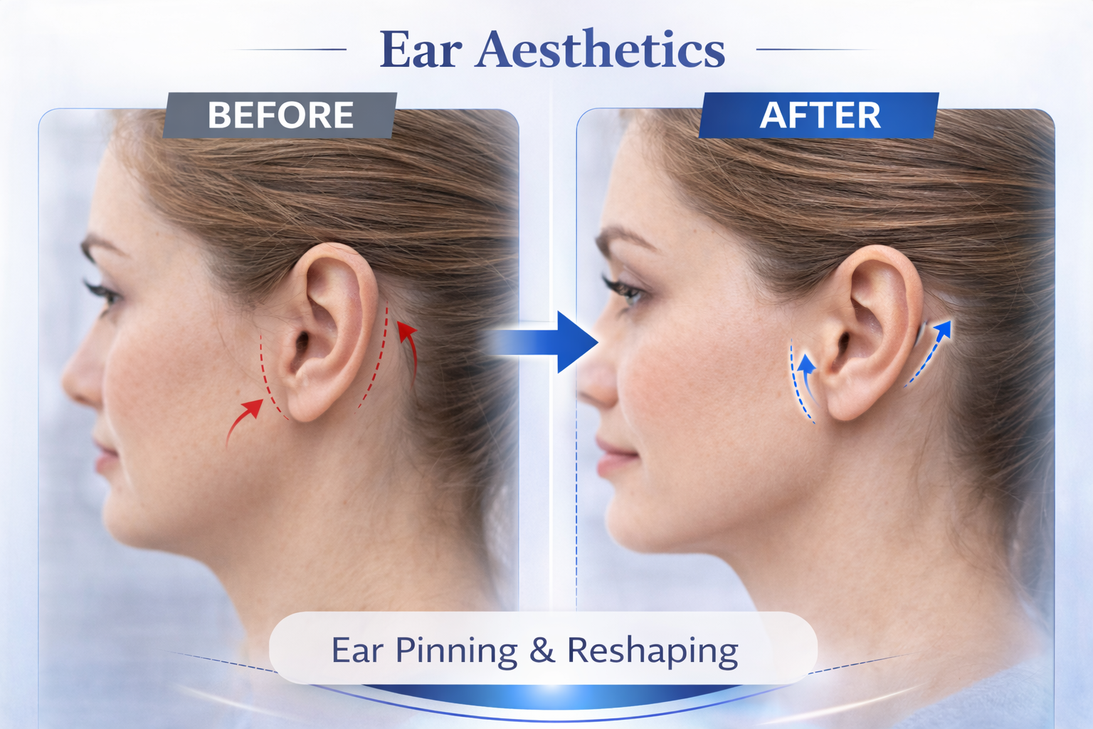 Ear Result